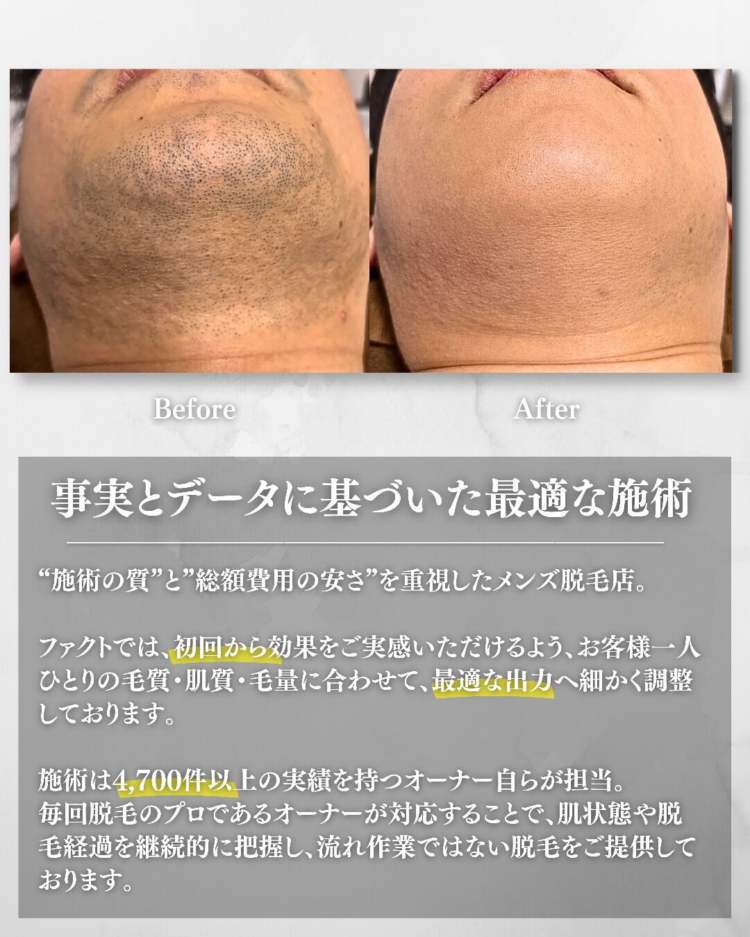 8月前半 【全身脱毛 空き状況】 7/30時点